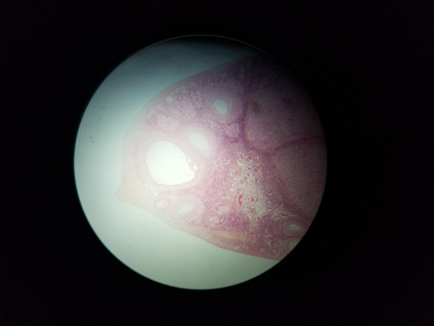Ovary Slides - Ovary 002 40X